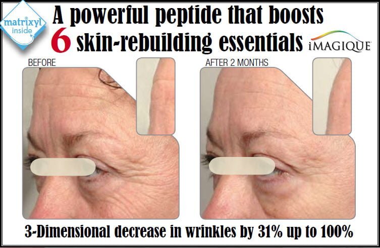 iMagique Age-Defying Eye Gel for Dark Circles and Puffiness