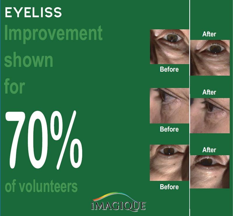iMagique Age-Defying Eye Gel for Dark Circles and Puffiness