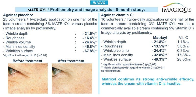 iMagique Age-Defying Eye Gel for Dark Circles and Puffiness