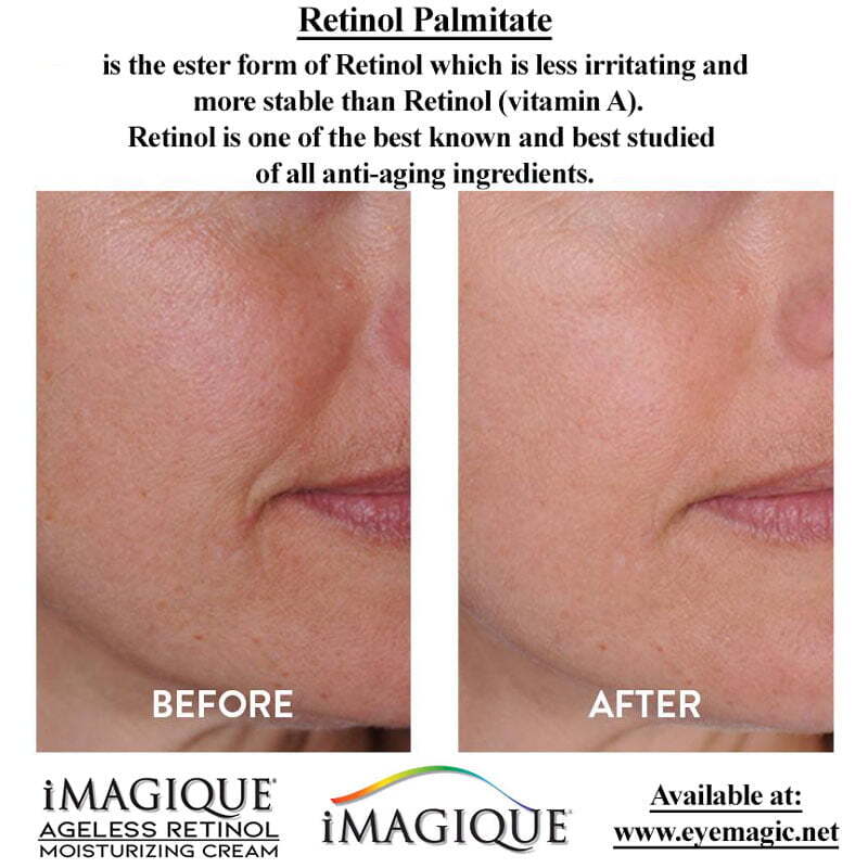 Ageless Retinol Moisturizing Cream by iMagique