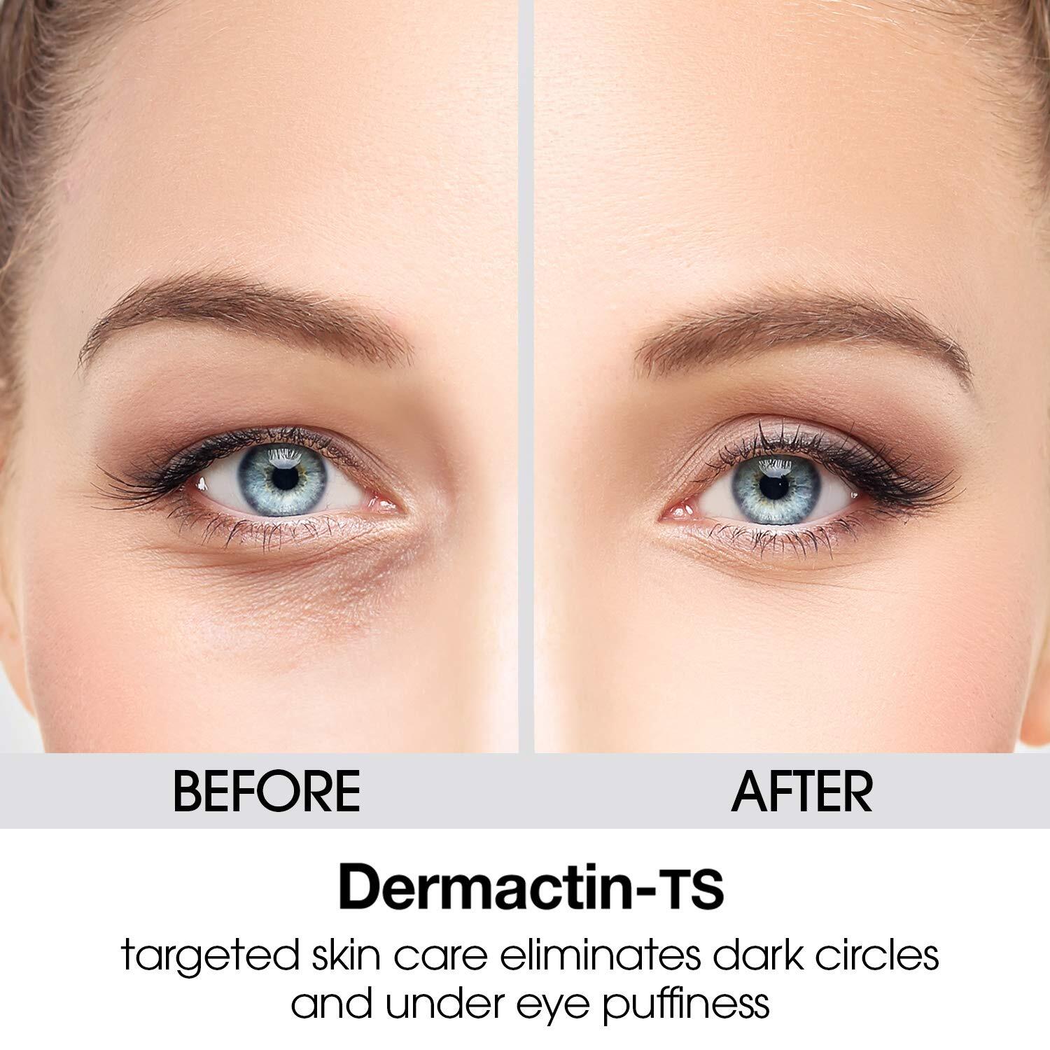 Dermactin-TS Cooling Puffy Eye Treatment Roller .34 oz.