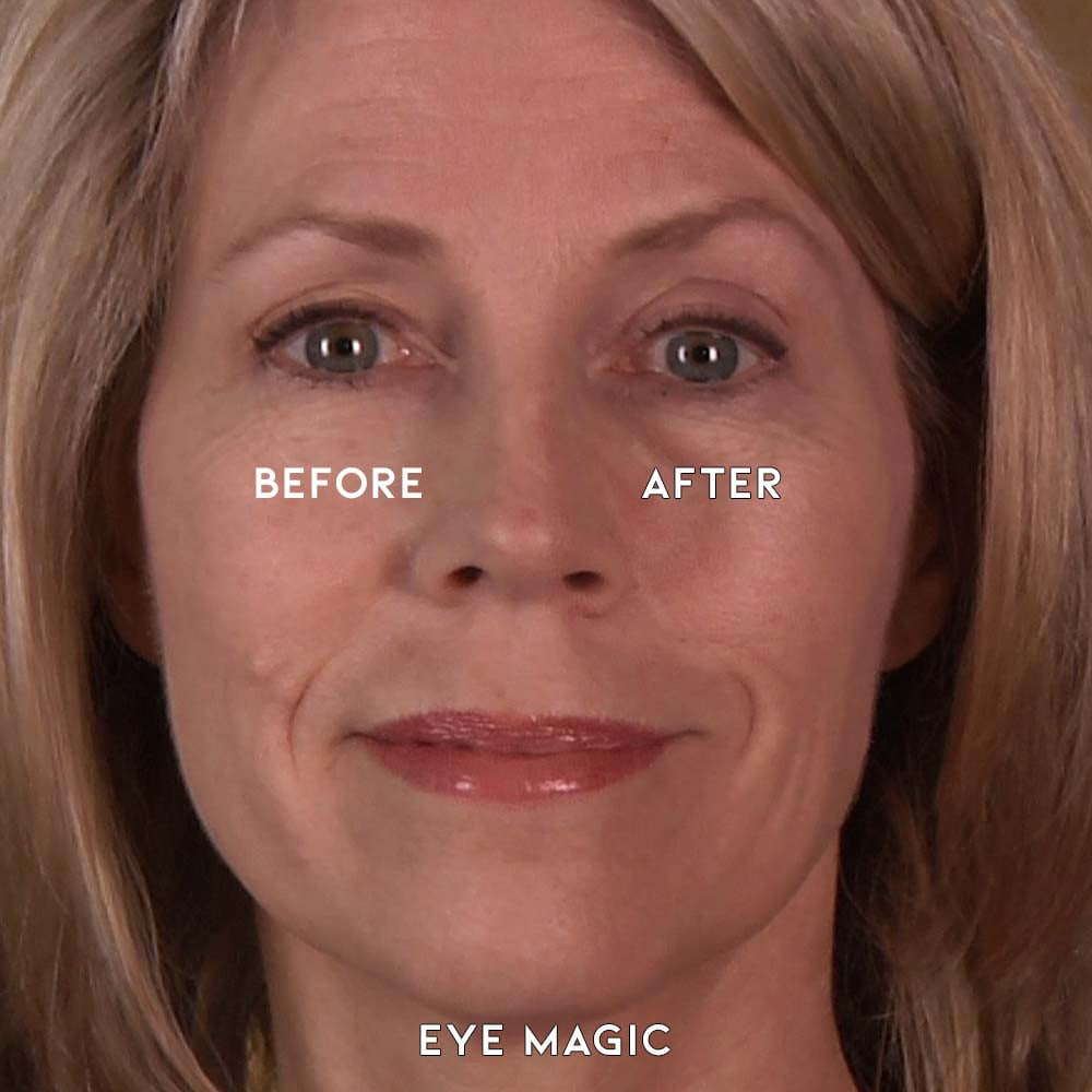 Butterfly Eye Lift results
