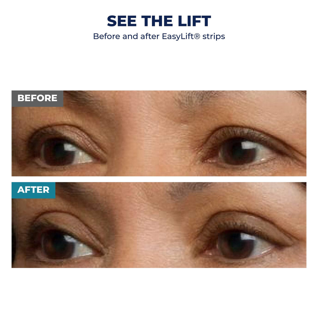 EasyLift before and after - second real result