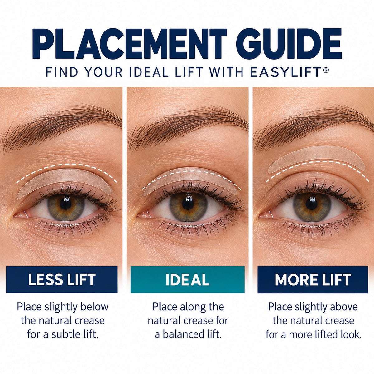 EasyLift placement guide: less lift, ideal, more lift