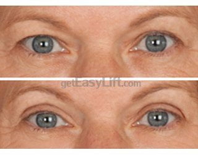 EasyLift Eye Lift package contents