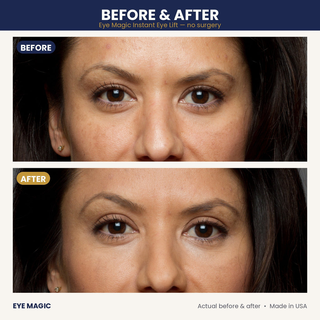 Eye Magic before and after - eyelid lift on deeper skin tone, close-up