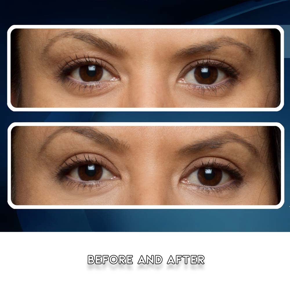 Eye Magic Premium Instant Eye Lift results