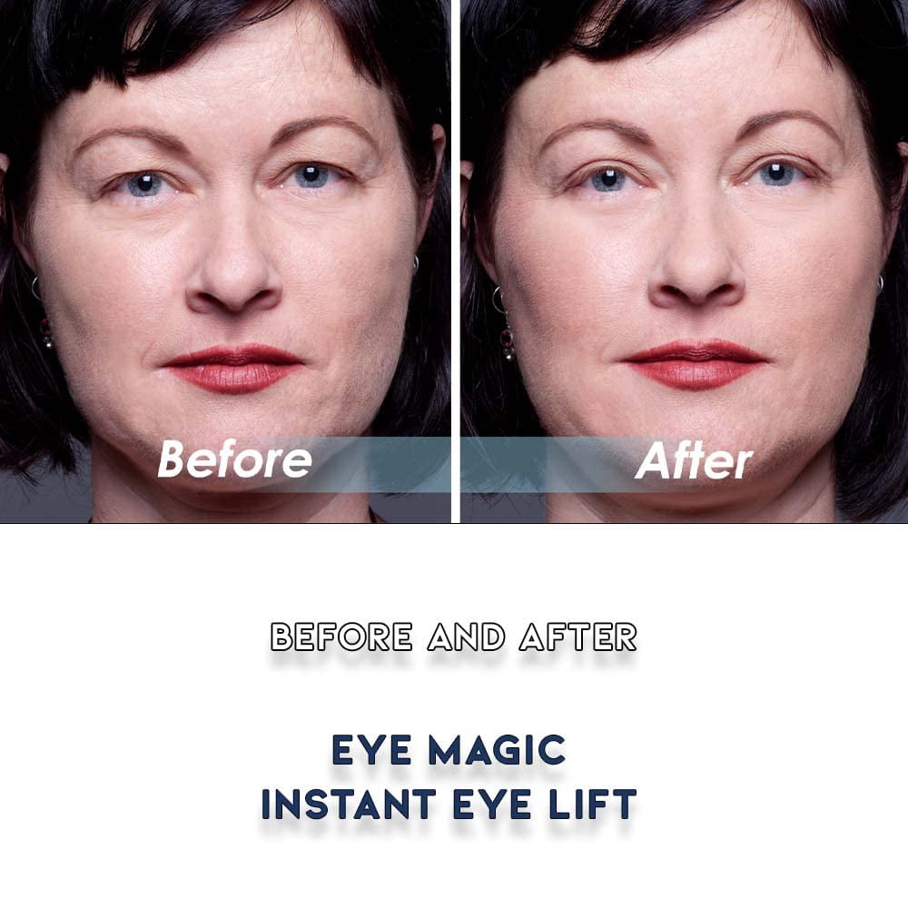Eye Magic Premium Instant Eye Lift before and after