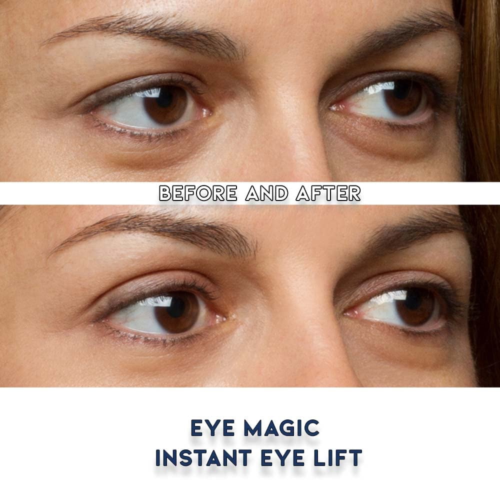 Eye Magic Premium Instant Eye Lift package