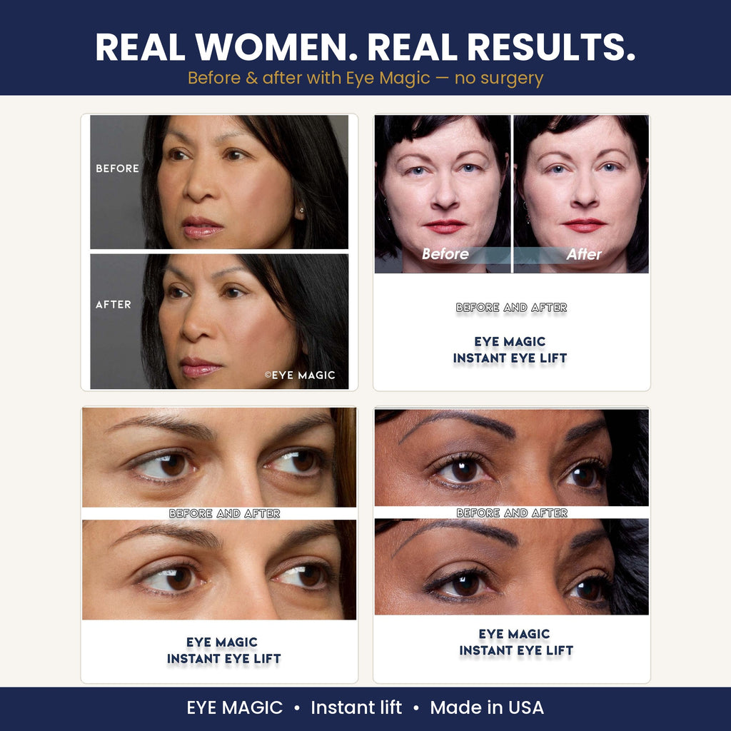 Real women, real results - four Eye Magic before and after photos