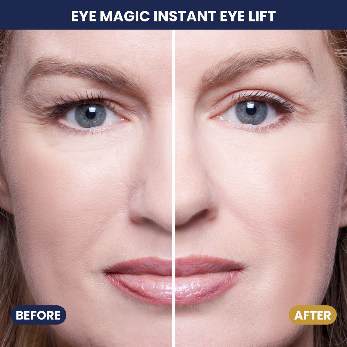 Eye Magic before and after - split-face comparison, hooded eyelids lifted
